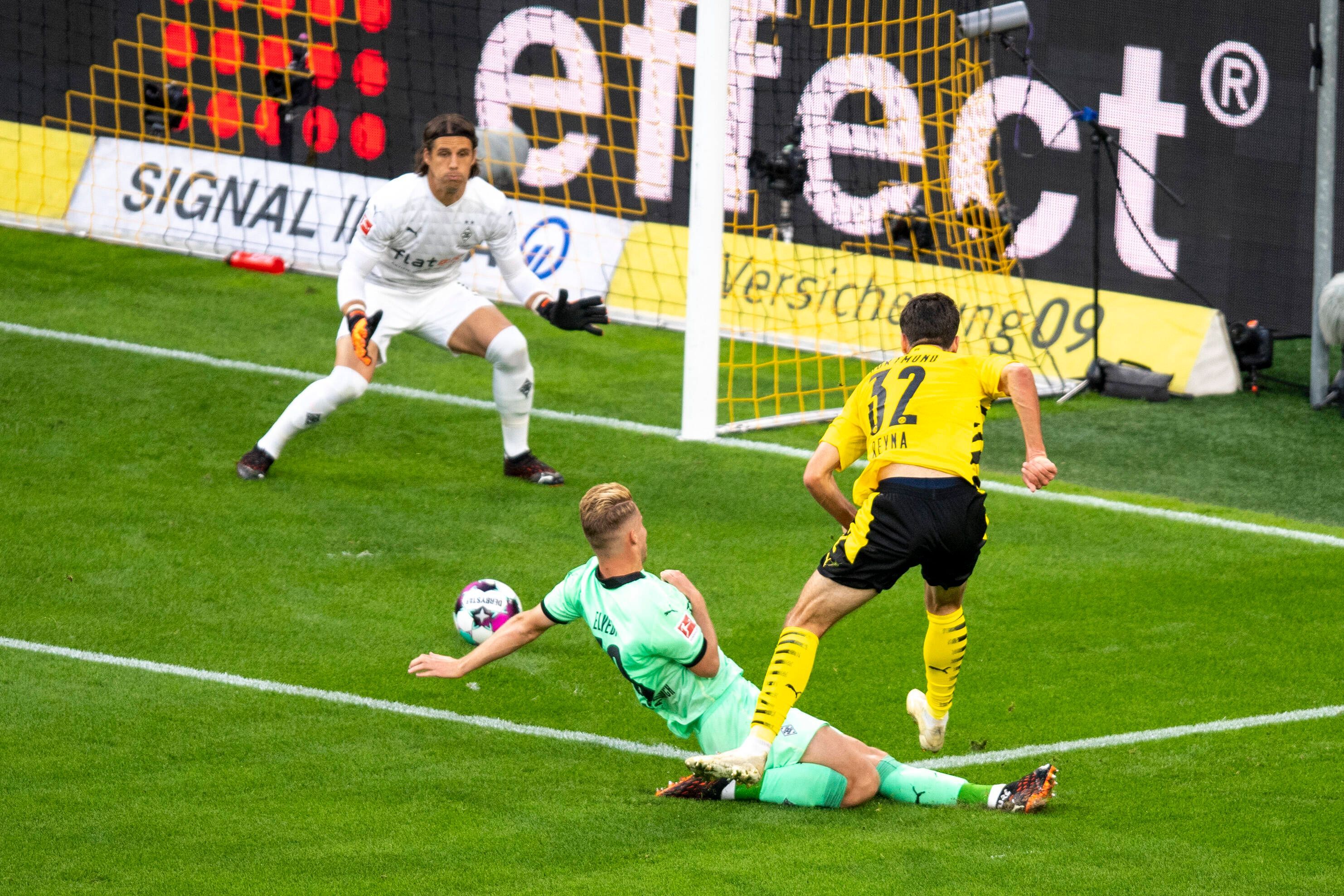 Yann Sommer von Borussia Mönchengladbach.