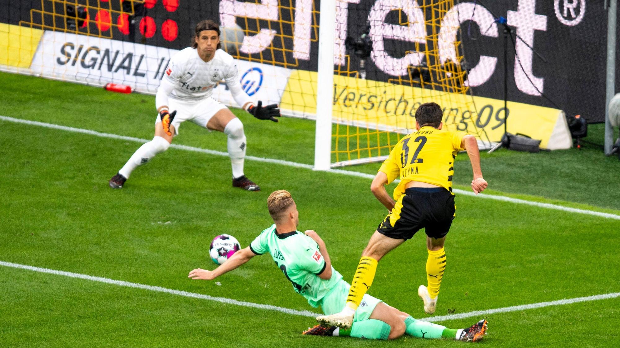 Yann Sommer von Borussia Mönchengladbach.