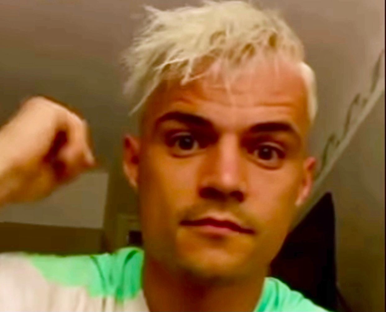 Ex-Gladbach-Kapitän Granit Xhaka hat sich die Haare blondieren lassen.
