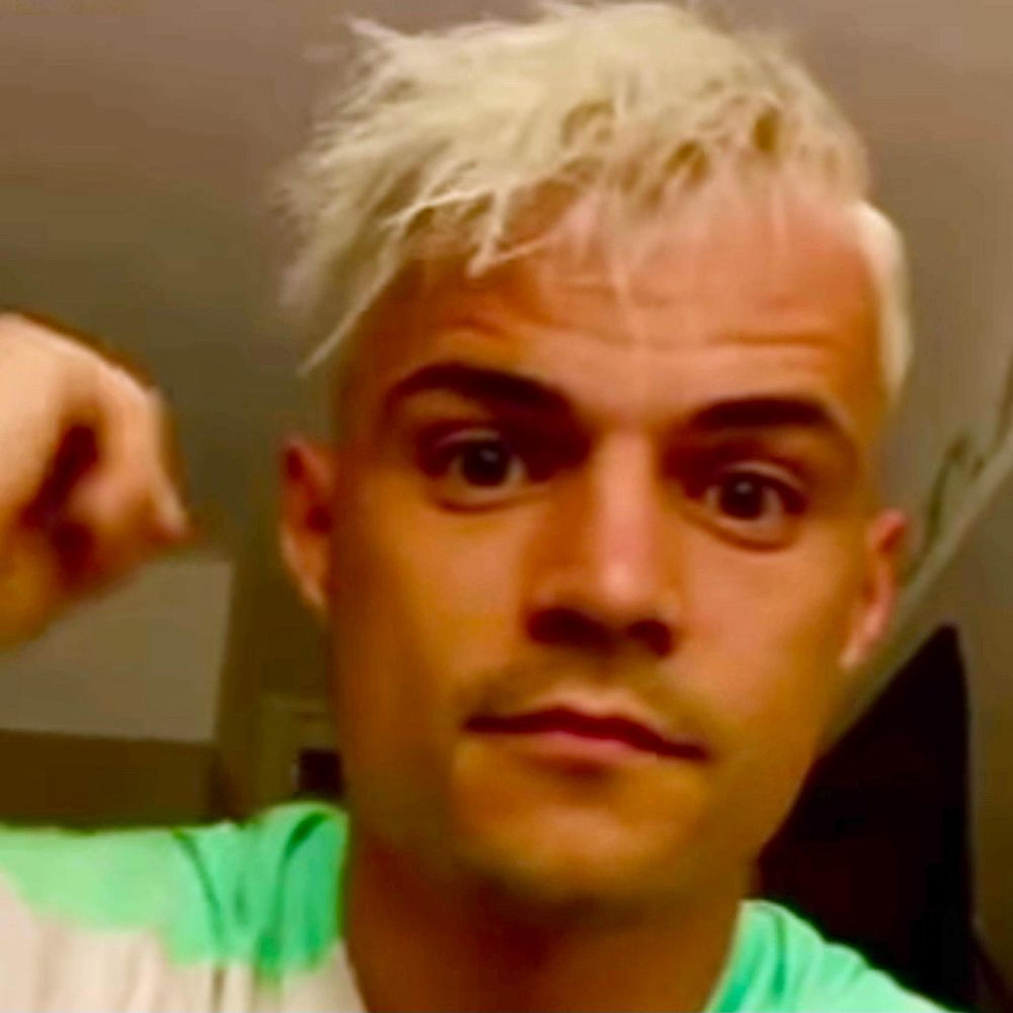 Ex-Gladbach-Kapitän Granit Xhaka hat sich die Haare blondieren lassen.